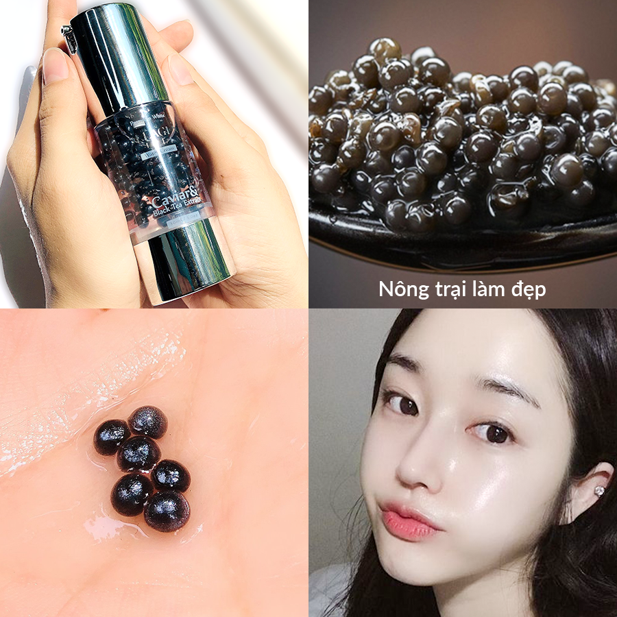 Trứng cá tầm
